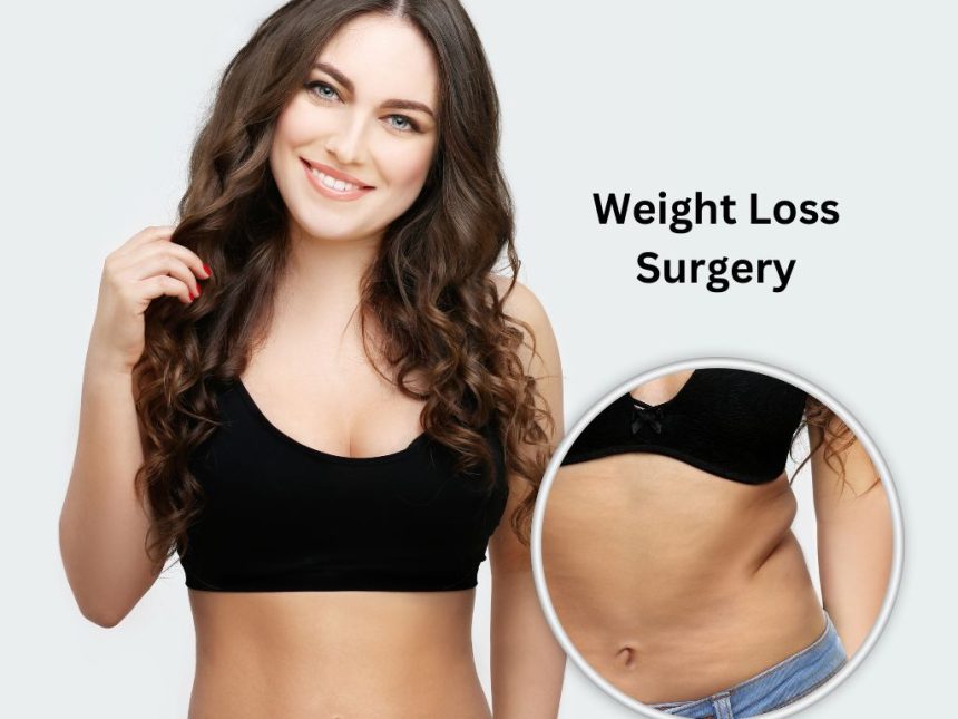 How to Choose the Best Weight Loss Surgery Loan Provider